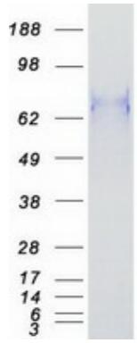 Coomassie blue staining of purified BCL6 protein.